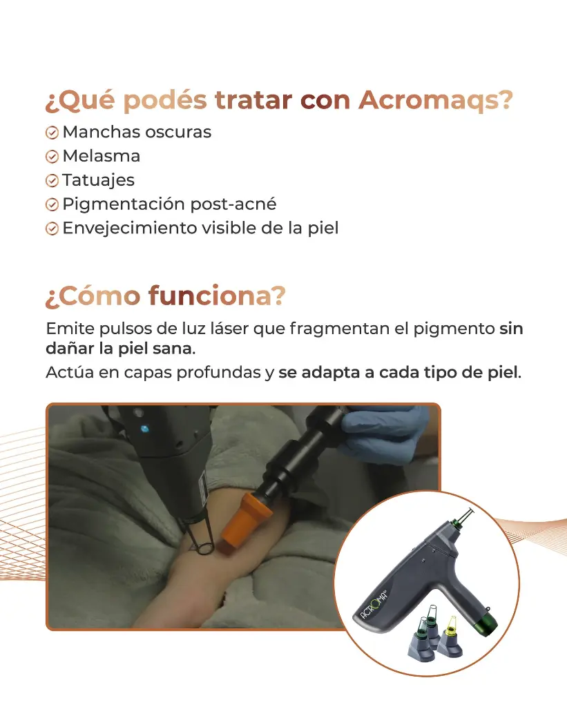 EthereaMX_ACROMA-QS_Placa_3.webp