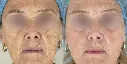 antes y despues-02.webp