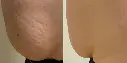 antes y despues-03.webp