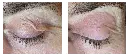 Antes y después 13.webp