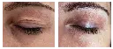 Antes y después 12.webp