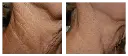 Antes y después 3.webp
