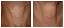 Antes y después 5.webp