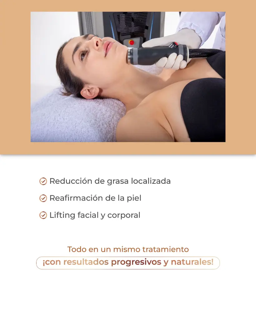 carrusel Onda pro-19.webp