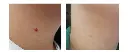 Antes y después AGAIN PRO 1.webp