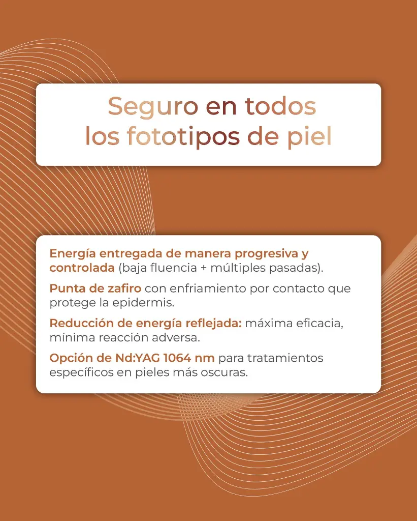 carrusel motus pro-15.webp