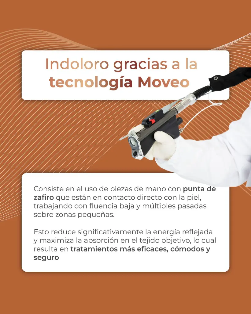 carrusel motus pro-14.webp