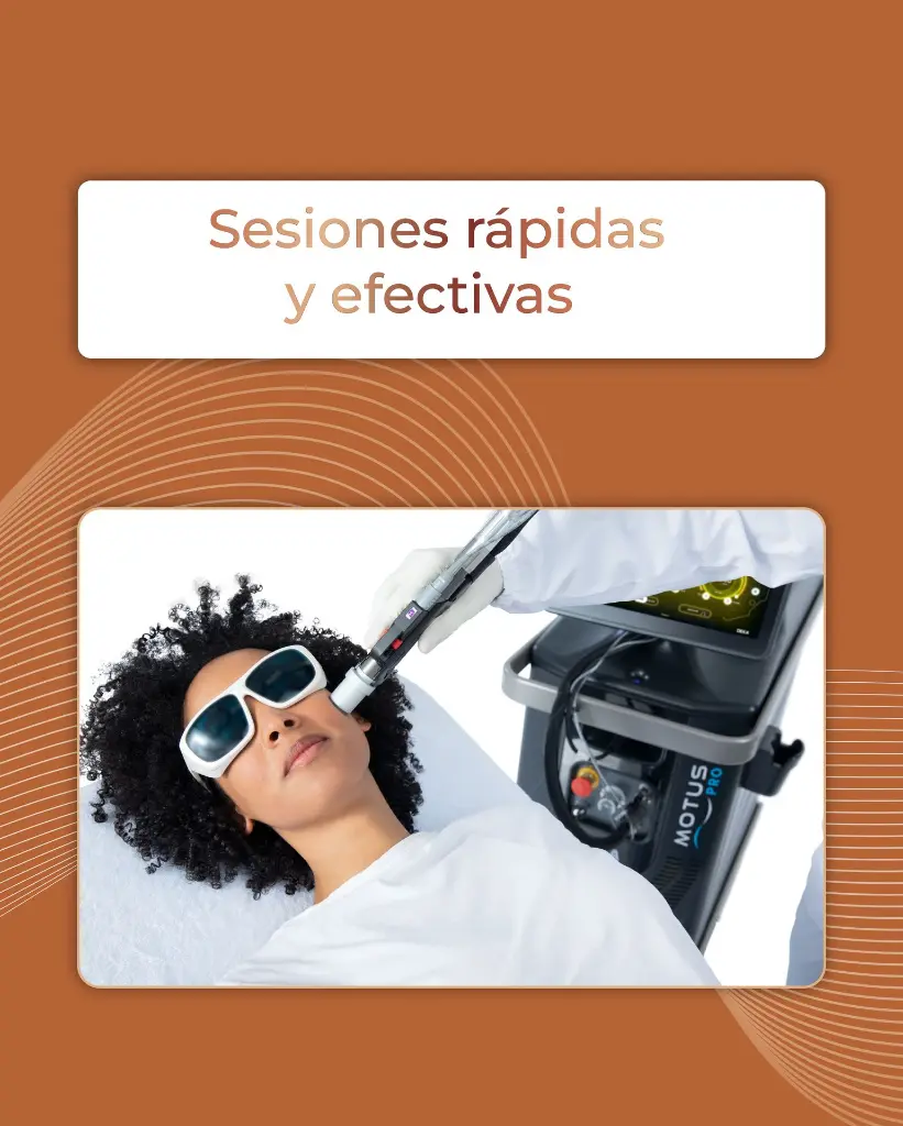 carrusel motus pro-16.webp