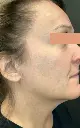 Motus-Pro_1_Después.webp