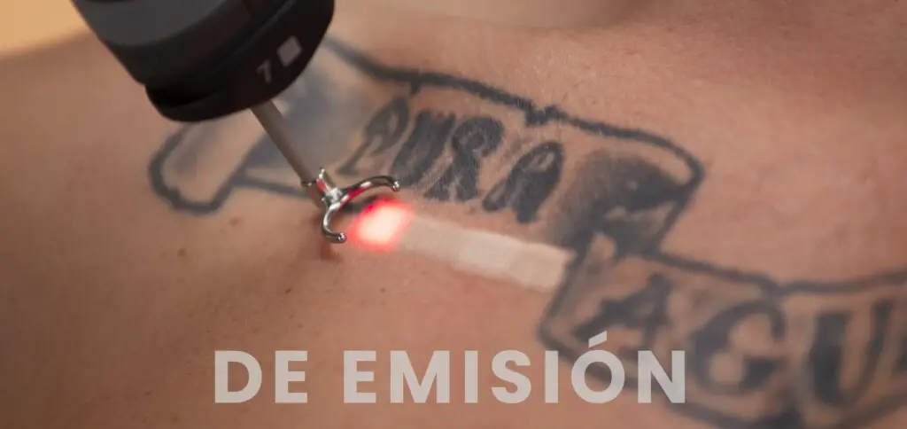 Laser-q-switched-TORO-melasma-lesiones-pigmentadas-DEKA-5-1024x484.webp
