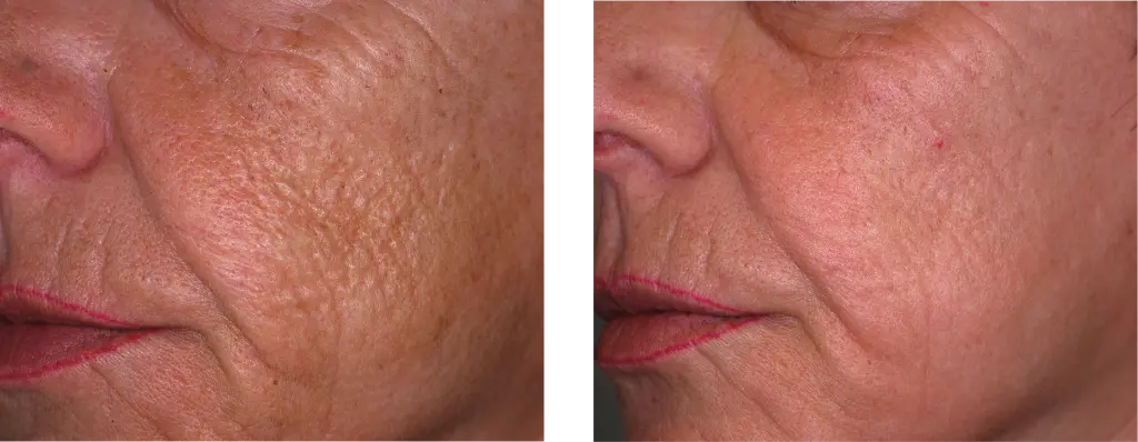 antes y despues-04.webp