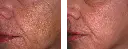 antes y despues-04.webp