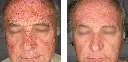 antes y despues-05.webp