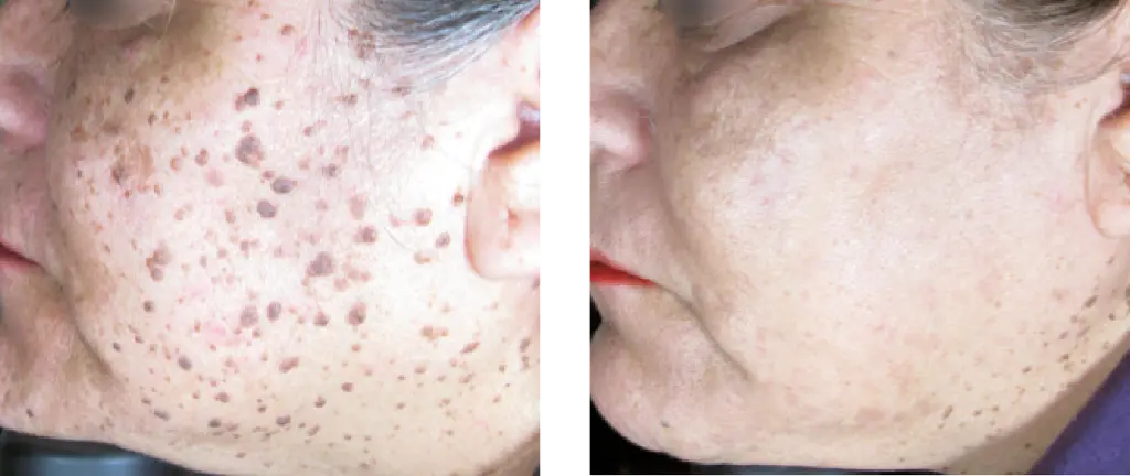 antes y despues-06.webp