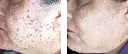 antes y despues-06.webp