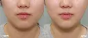 Doublo Antes y despues - 1.webp
