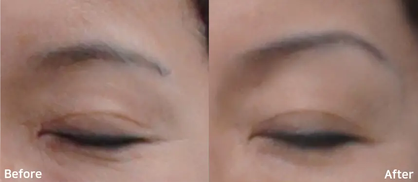 Doublo Antes y despues - 2.webp