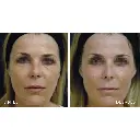 Viscoderm 3.webp