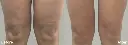 Doublo Antes y despues - 6.webp