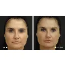 Viscoderm 4.webp