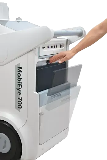 MobiEye-700 retropad.webp