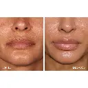 Aliaxin SV 4.webp