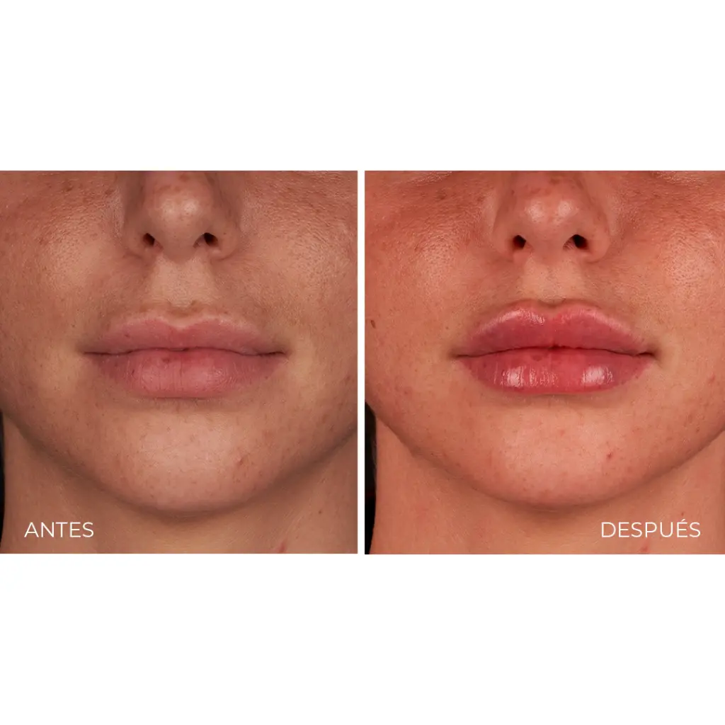 Aliaxin SV 3.webp