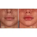 Aliaxin SV 3.webp
